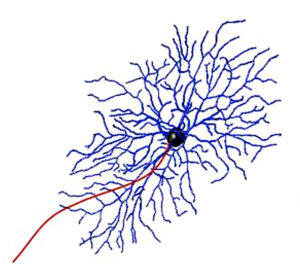 Example of a retinal ganglion cell, composed of a rounded, central body with numerous small projections and one long projection, or axon, that communicates with the brain (red). Vision scientists at the USC Ginsburg Institute are developing techniques to activate the bodies of specific cells without stimulating the projections of nearby cells, which will help sharpen the visual information that retinal prosthetics can offer patients.